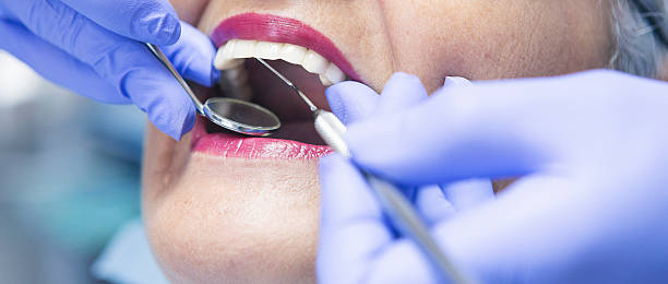 Best Dental Abscess Treatment in Springfield, GA